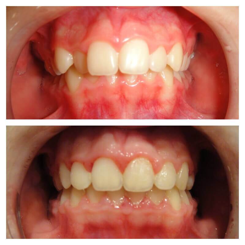 Ortodoncia a čeľustná ortopédia Ortho Keep Smiling